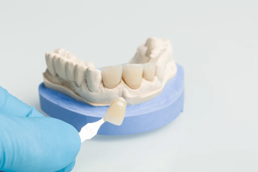 Dental Crowns in East Brunswick, NJ