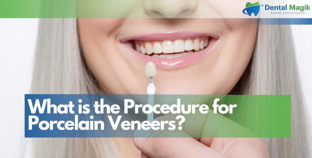 What is the Procedure for Porcelain Veneers?