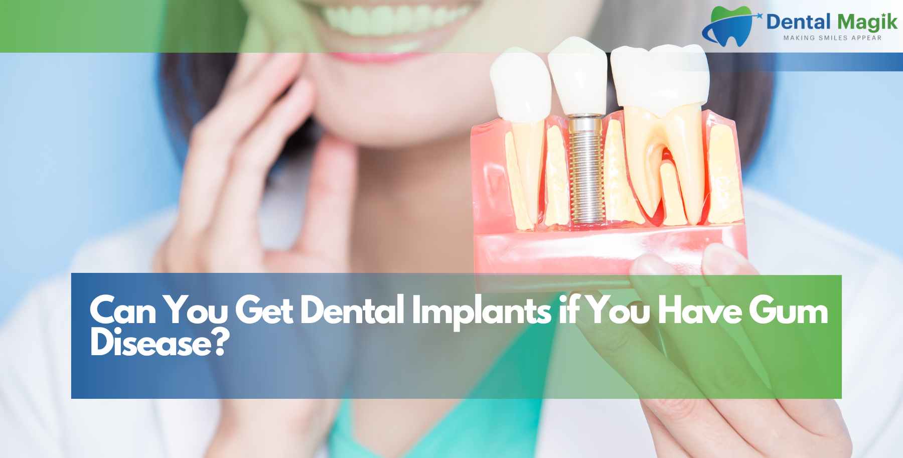 Can You Get Dental Implants if You Have Gum Disease?