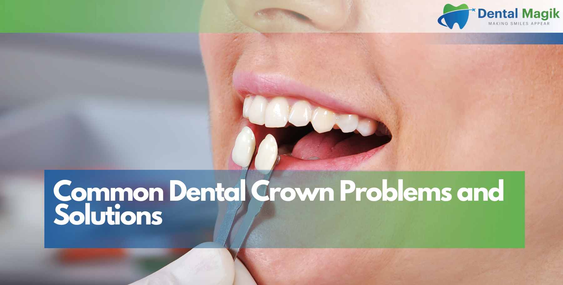 Common Dental Crown Problems and Solutions