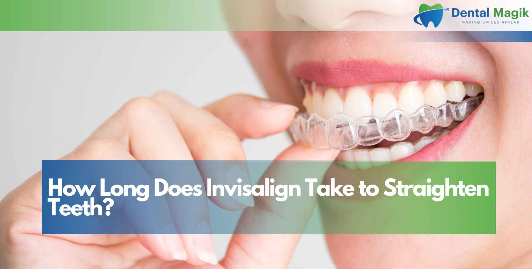 How Long Does Invisalign Take to Straighten Teeth?