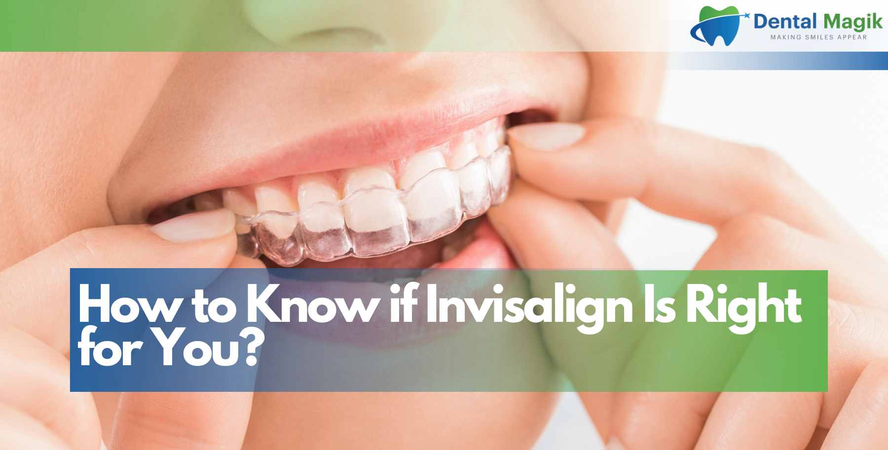 How to Know if Invisalign Is Right for You?