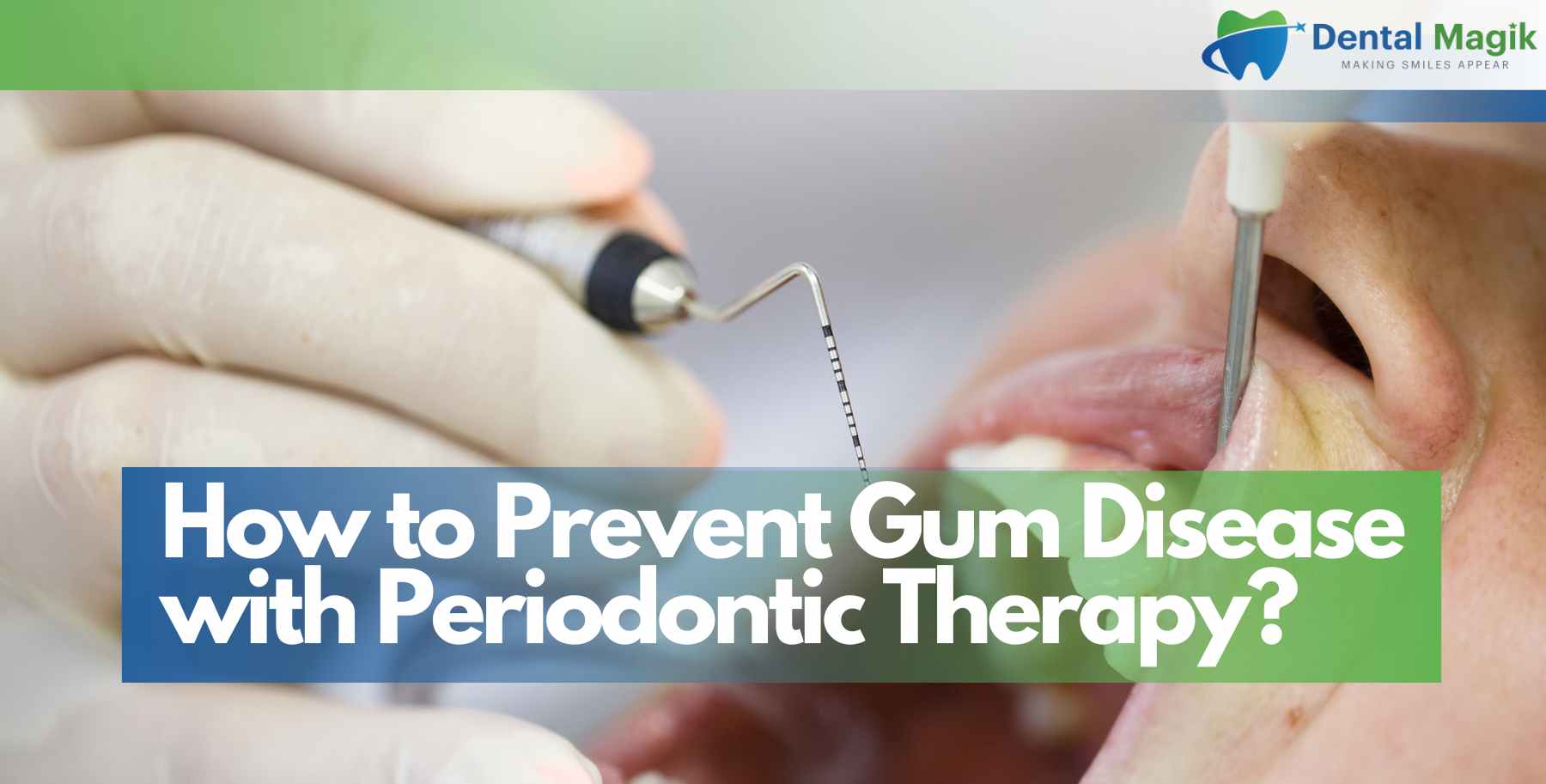 How to Prevent Gum Disease with Periodontic Therapy?