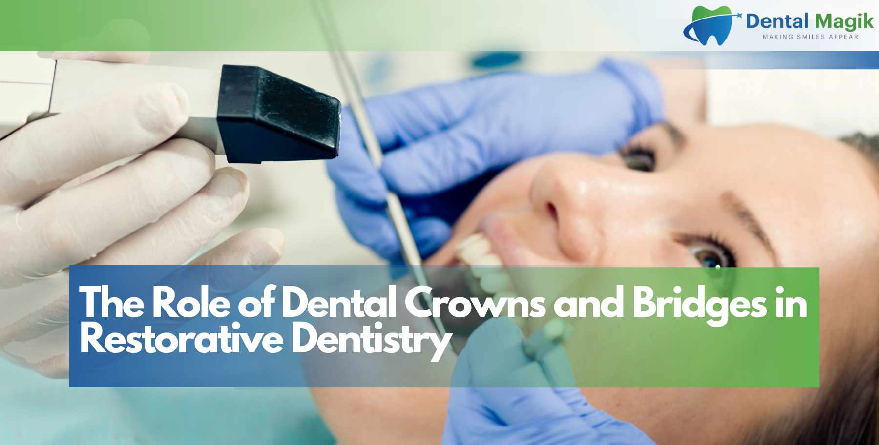 The Role of Dental Crowns and Bridges in Restorative Dentistry