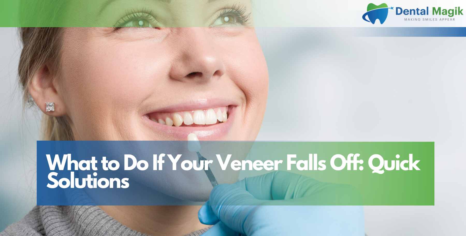 What to Do If Your Veneer Falls Off: Quick Solutions