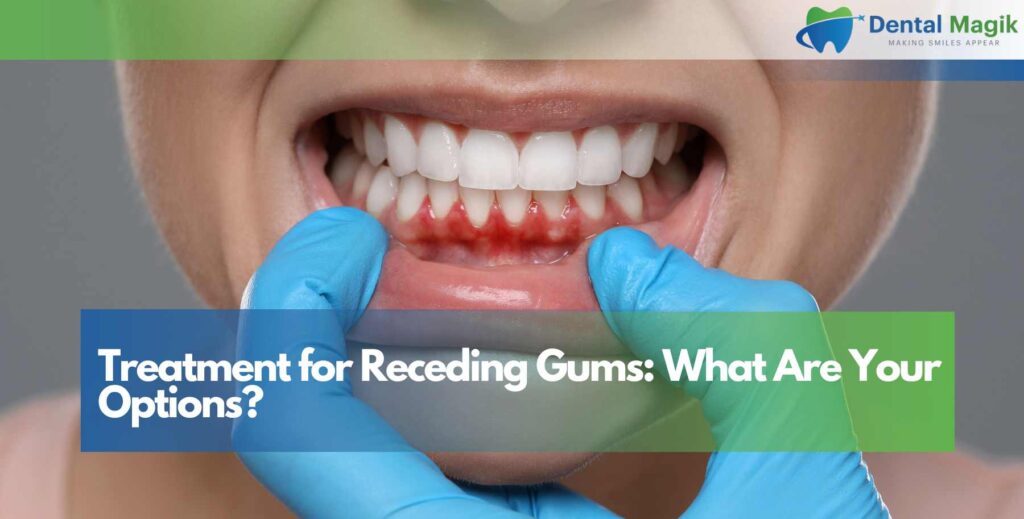 Treatment for Receding Gums: What Are Your Options?