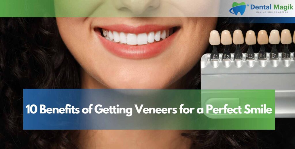 10 Benefits of Getting Veneers for a Perfect Smile