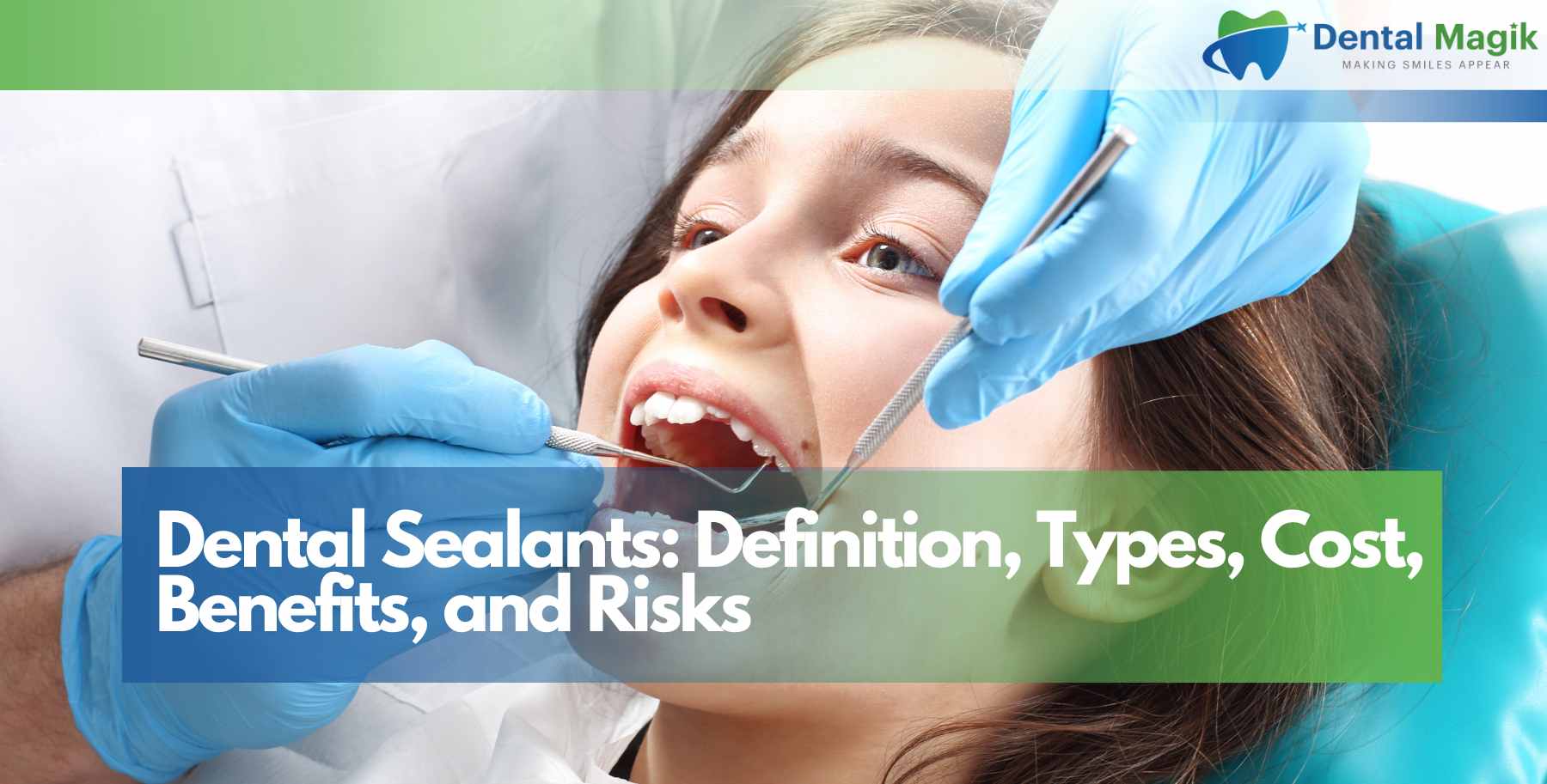 Dental Sealants: Definition, Types, Cost, Benefits, and Risks