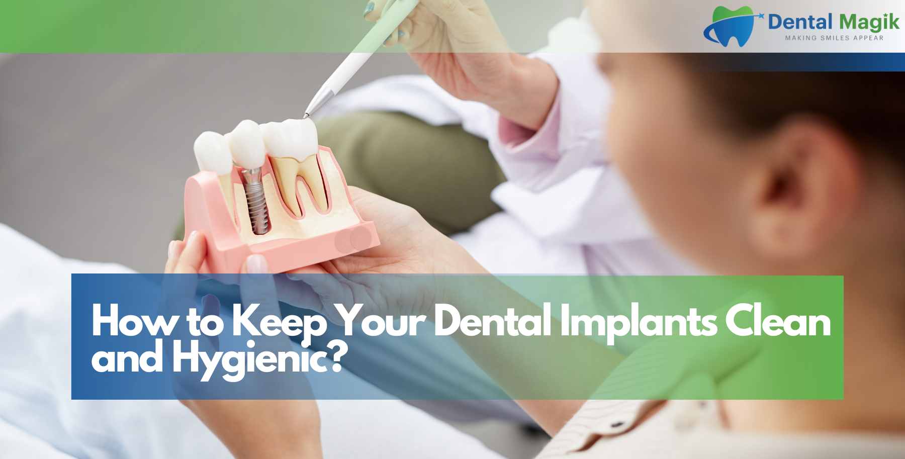 How to Keep Your Dental Implants Clean and Hygienic?