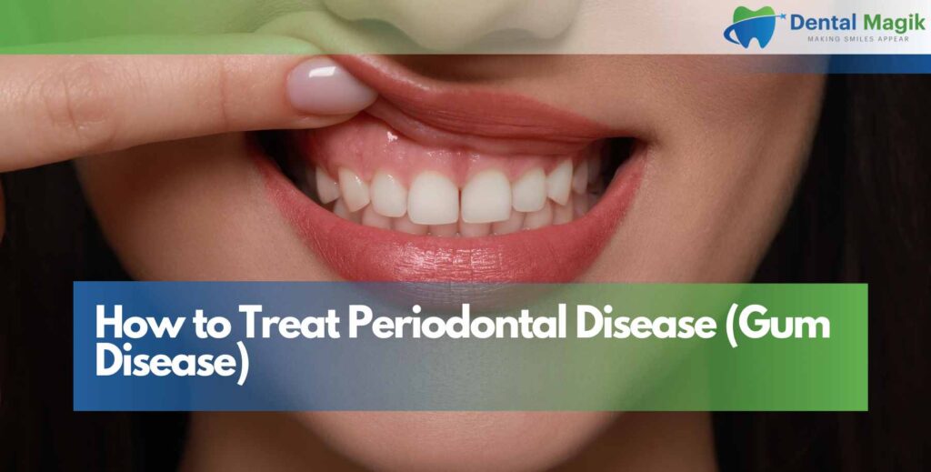 How to Treat Periodontal Disease (Gum Disease)