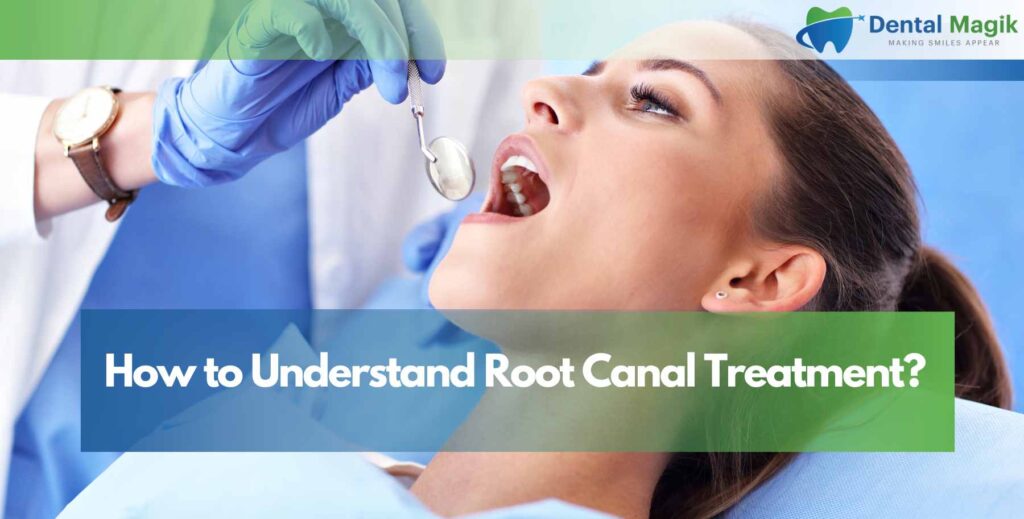 How to Understand Root Canal Treatment?