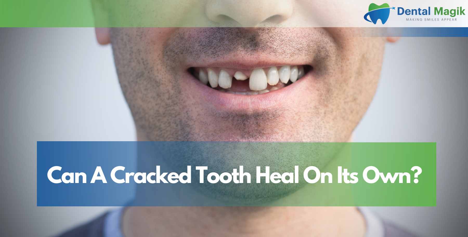 Can A Cracked Tooth Heal On Its Own?