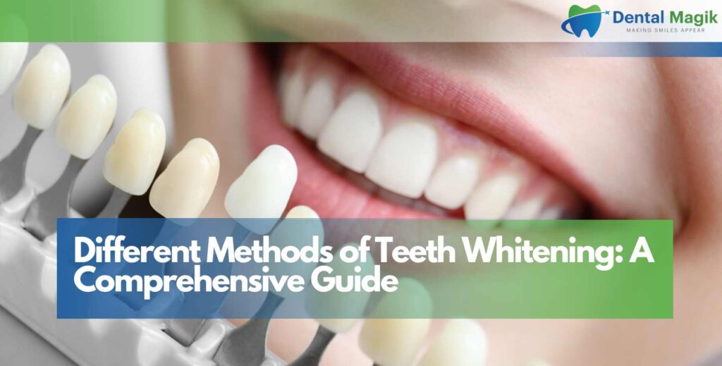 Different Methods of Teeth Whitening: A Comprehensive Guide