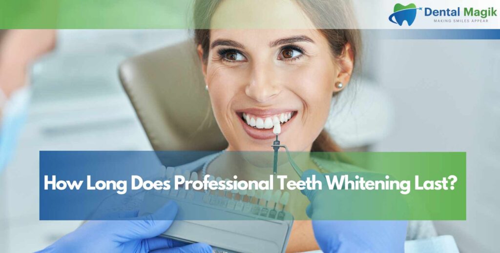 How Long Does Professional Teeth Whitening Last?