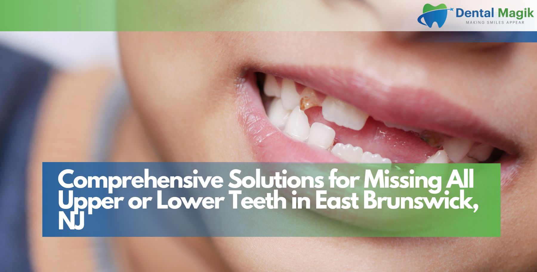 Missing All Upper or Lower Teeth in East Brunswick, NJ
