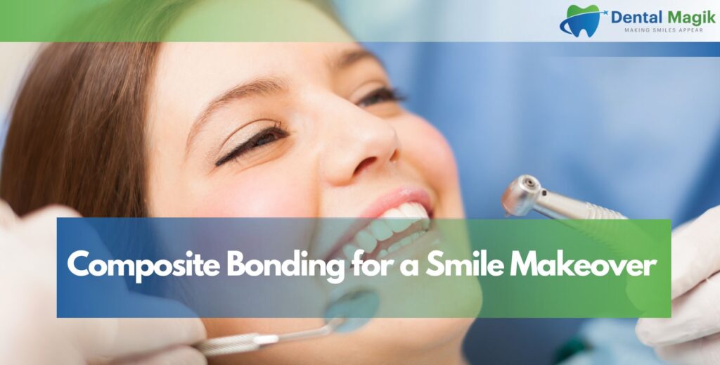 Composite Bonding for a Smile Makeover