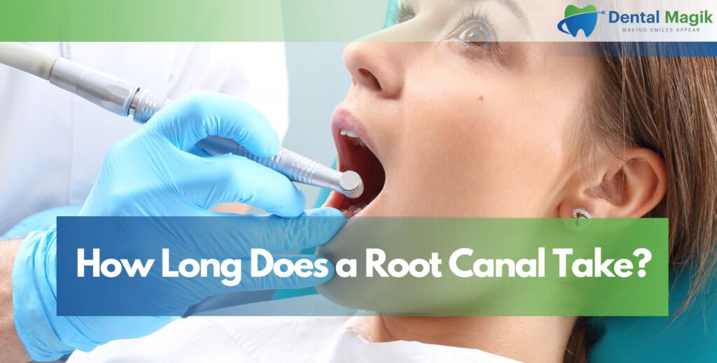 How Long Does a Root Canal Take?