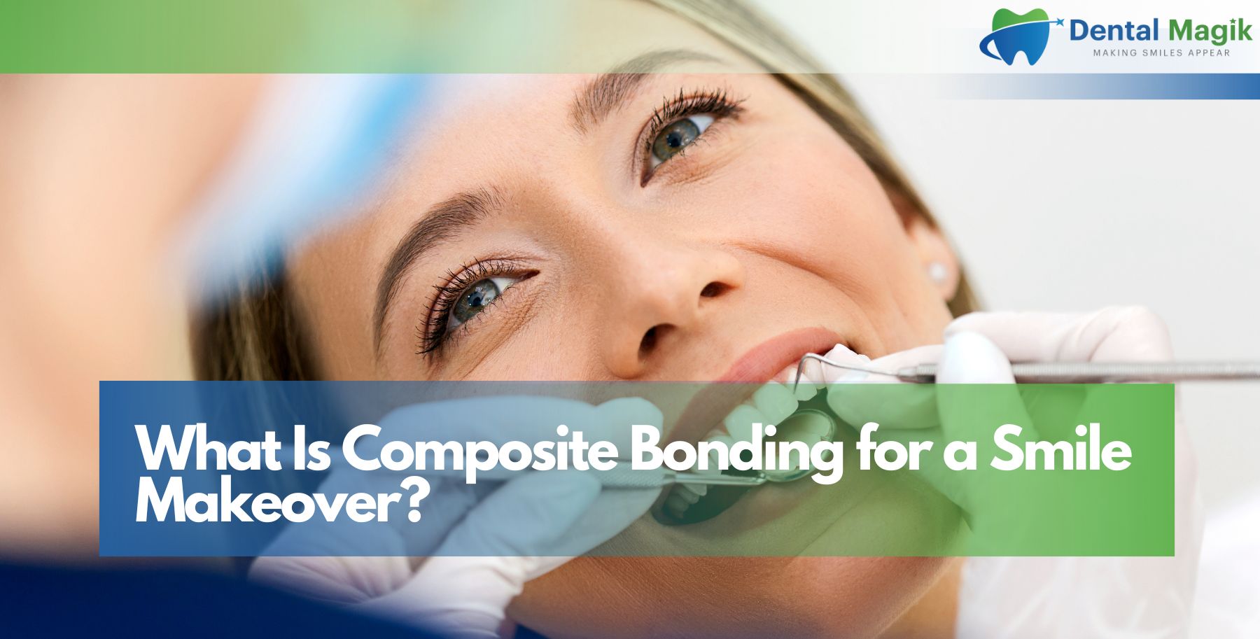 What Is Composite Bonding for a Smile Makeover?