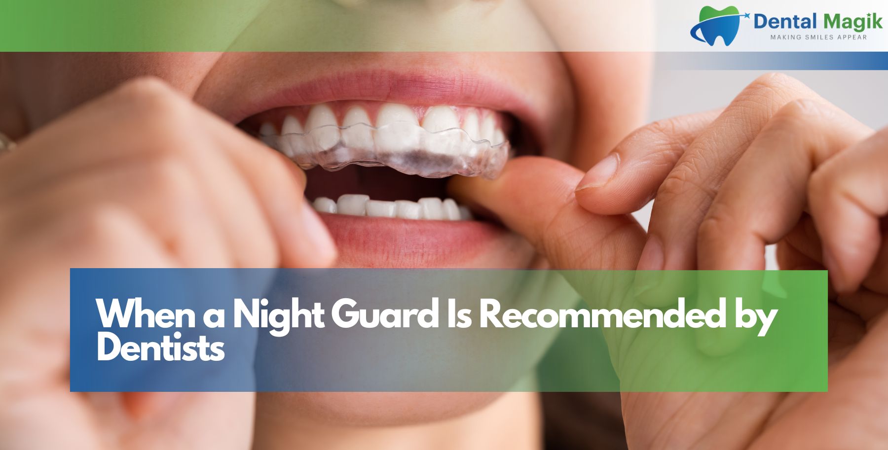 When a Night Guard Is Recommended by Dentists