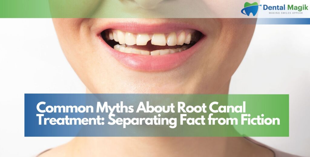 Common Myths About Root Canal Treatment