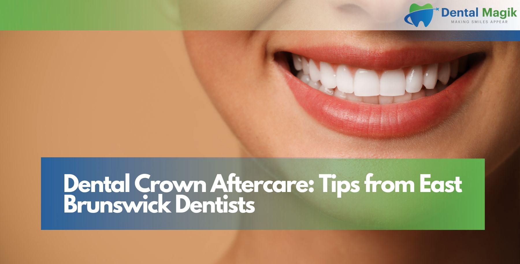 Dental Crown Aftercare: Tips from East Brunswick Dentists