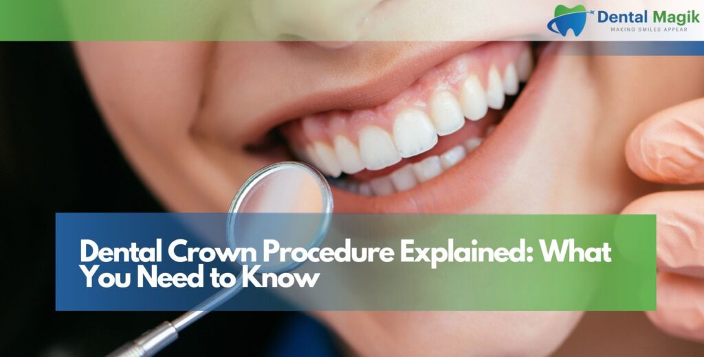 Dental Crown Procedure Explained