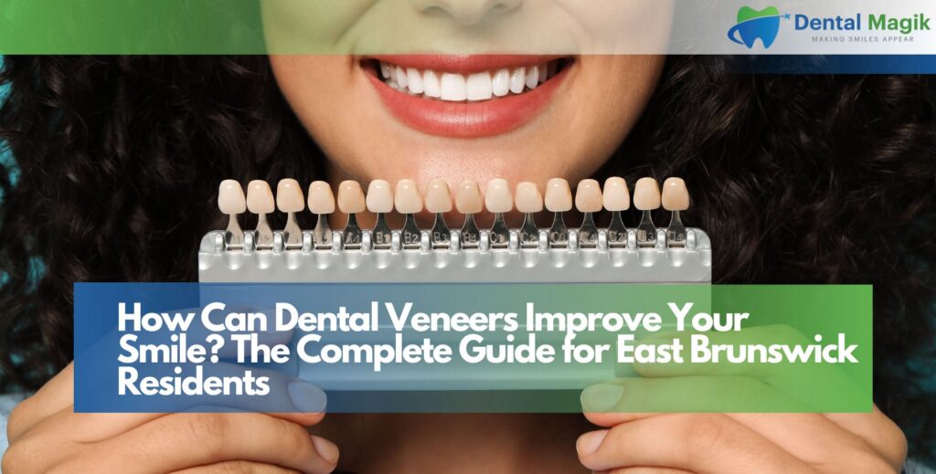 How Can Dental Veneers Improve Your Smile?