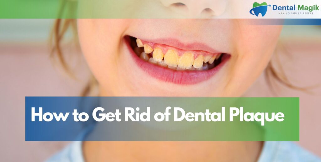 How to Get Rid of Dental Plaque
