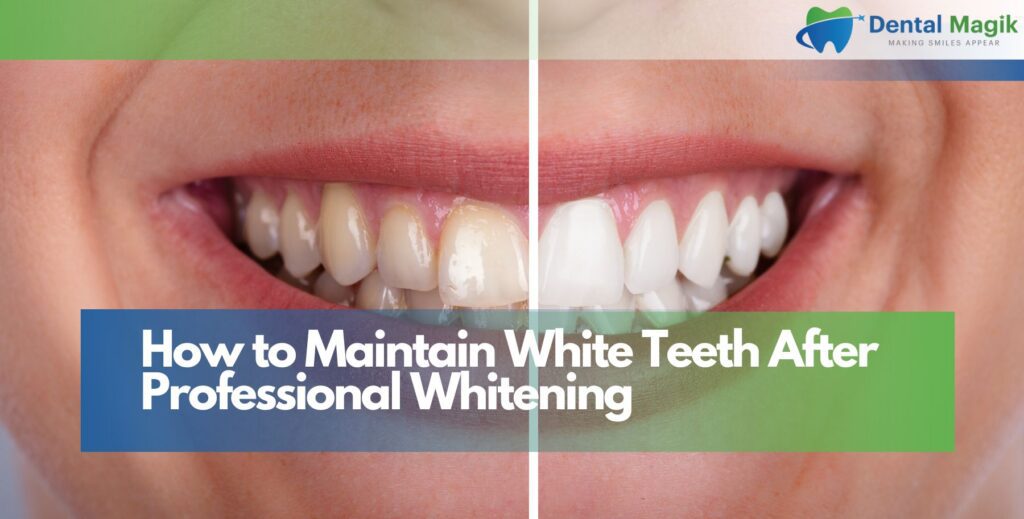 How to Maintain White Teeth After Professional Whitening