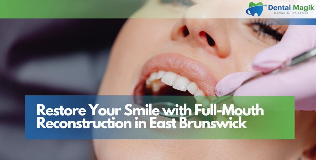 Full-Mouth Reconstruction in East Brunswick