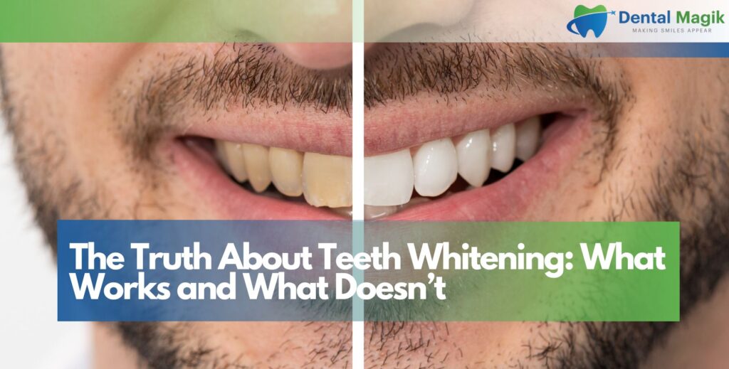 The Truth About Teeth Whitening: What Works and What Doesn’t