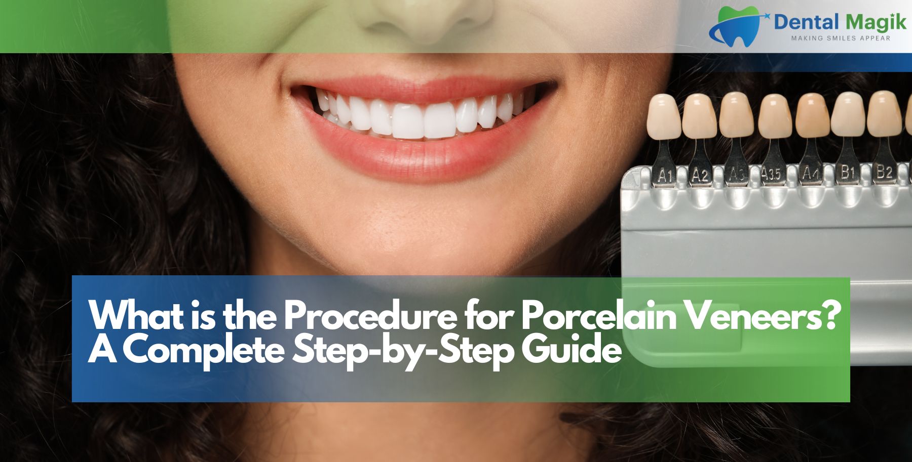 What is the Procedure for Porcelain Veneers?
