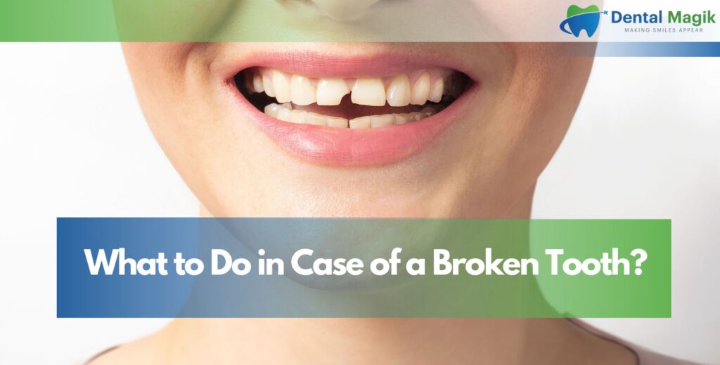 What to Do in Case of a Broken Tooth?