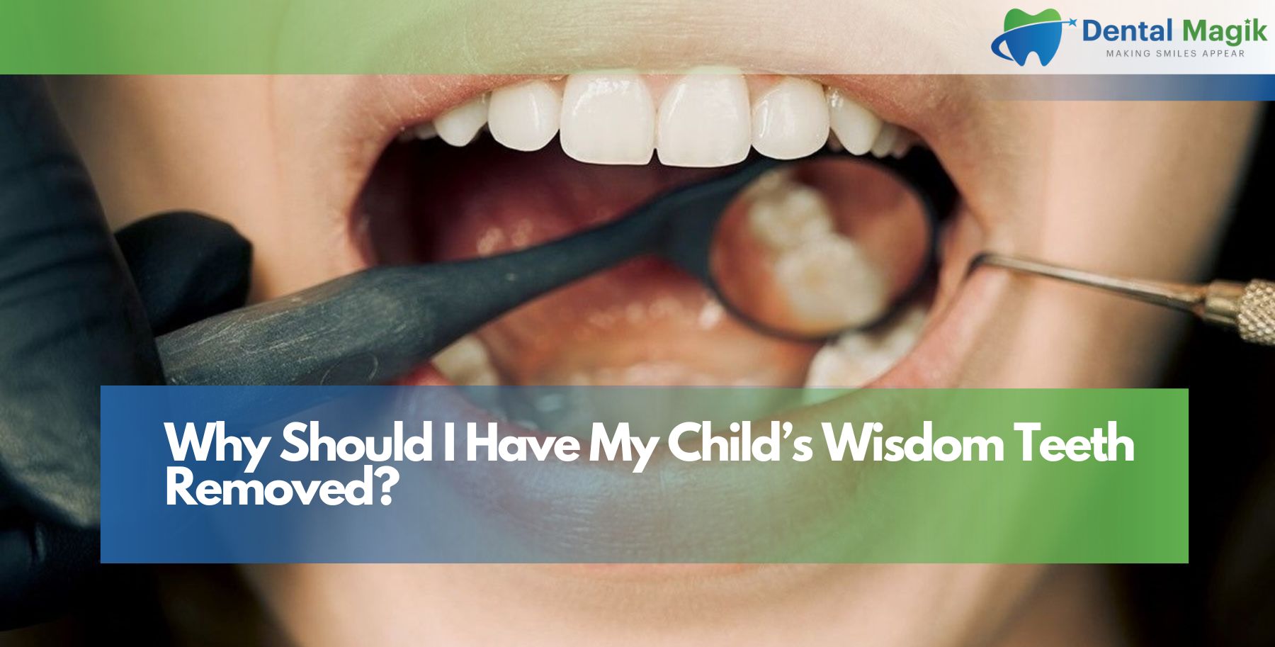Why Should I Have My Child’s Wisdom Teeth Removed?