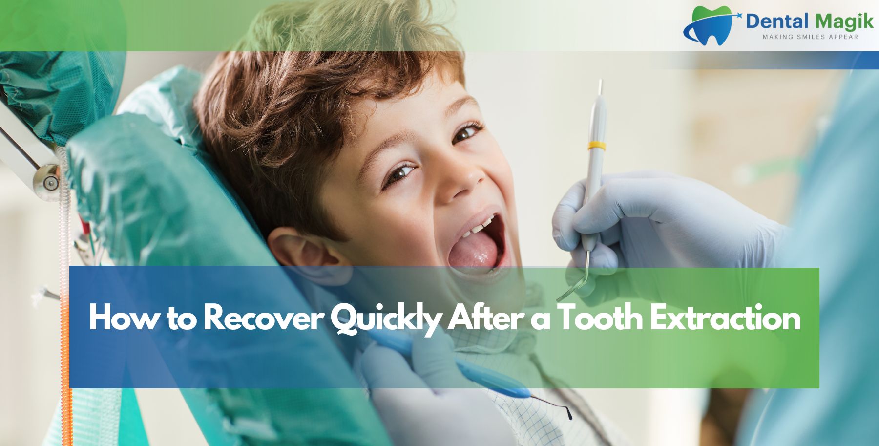 How to Recover Quickly After a Tooth Extraction