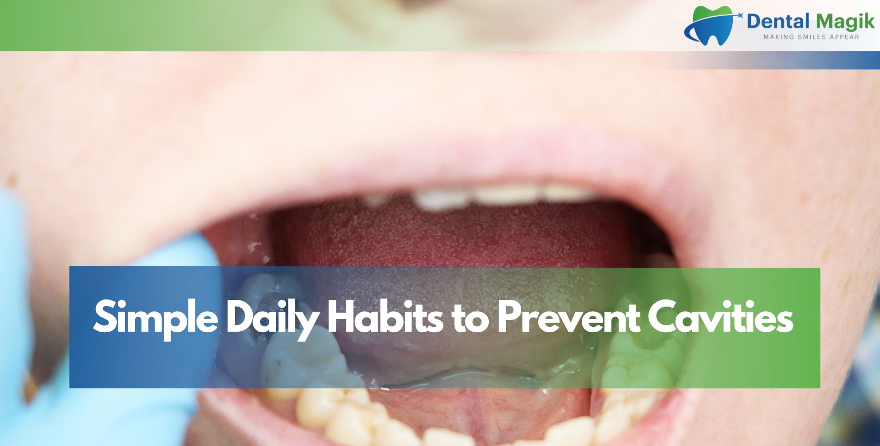 Simple Daily Habits to Prevent Cavities