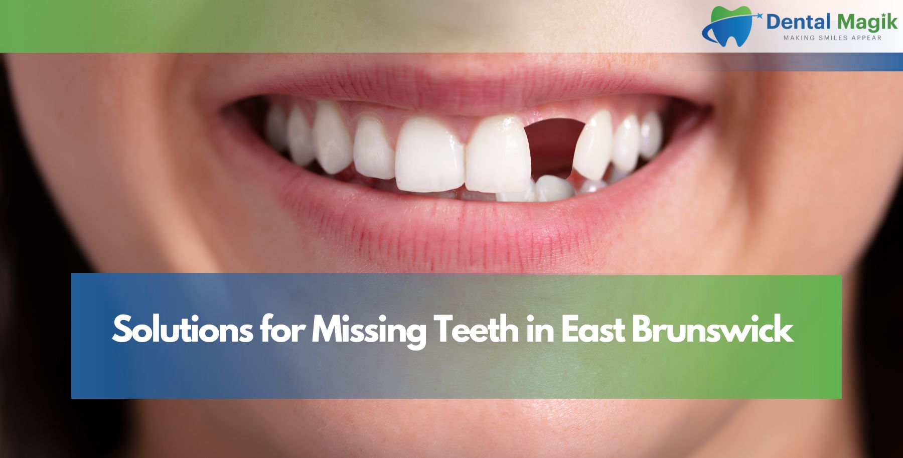 Solutions for Missing Teeth in East Brunswick
