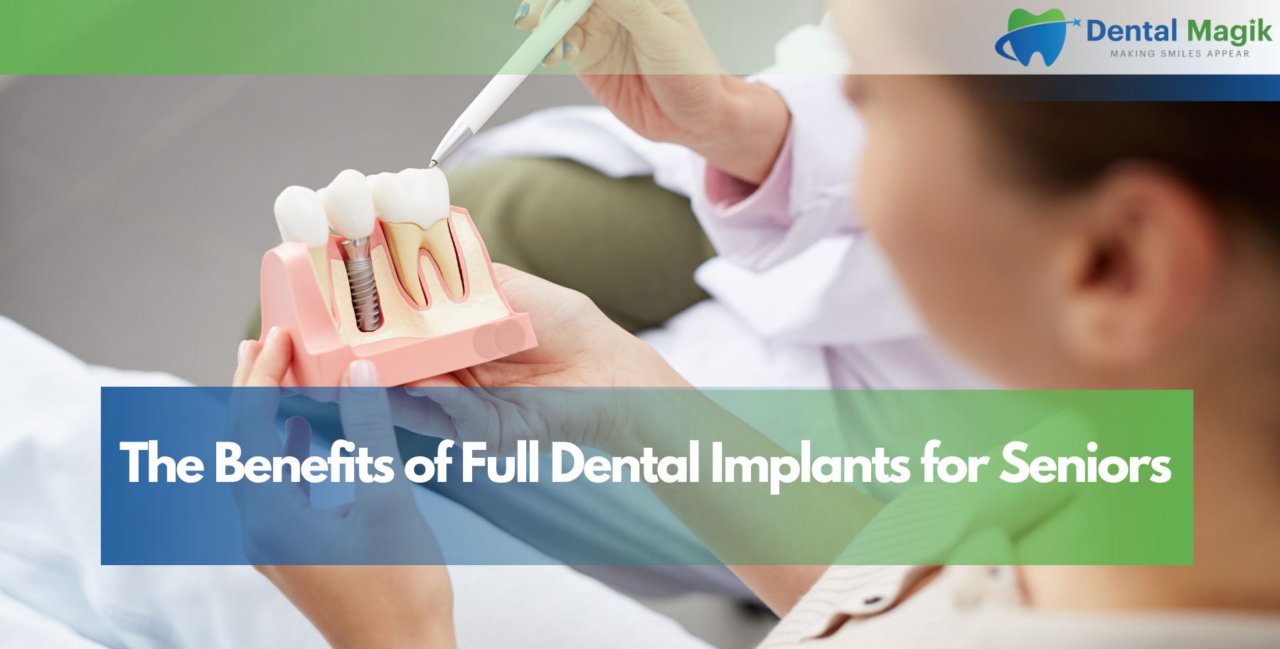The Benefits of Full Dental Implants for Seniors