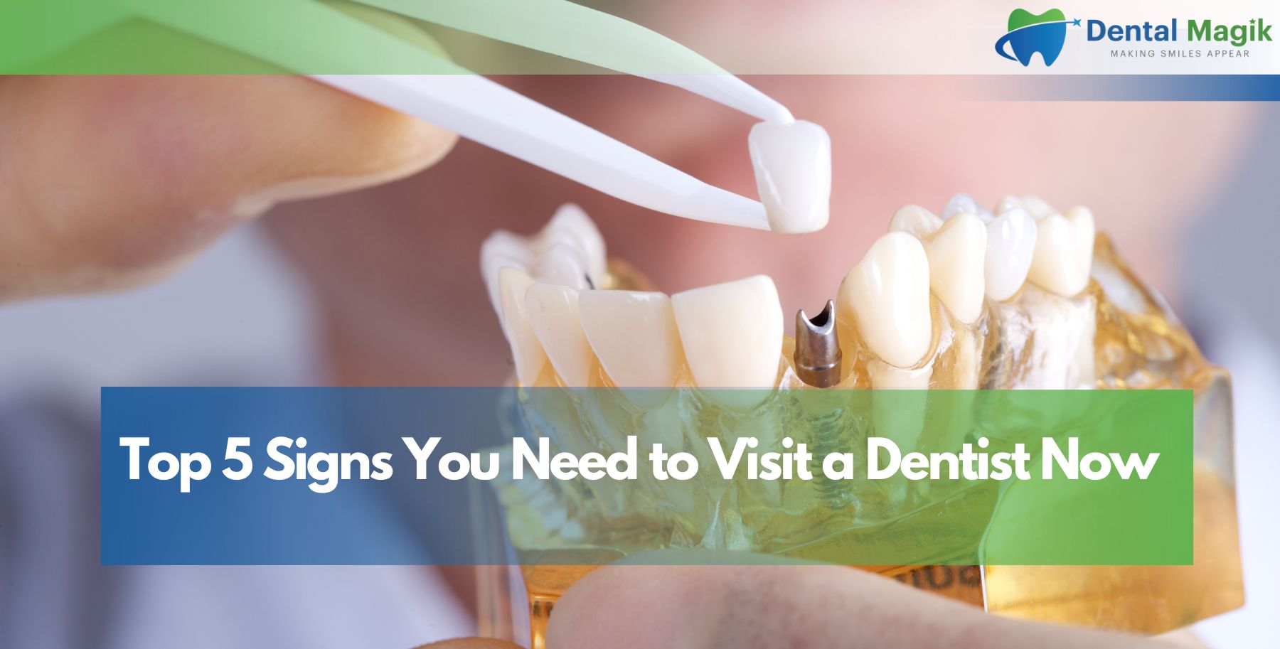 Top 5 Signs You Need to Visit a Dentist Now