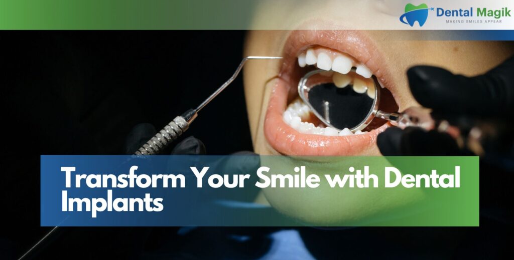 Transform Your Smile with Dental Implants