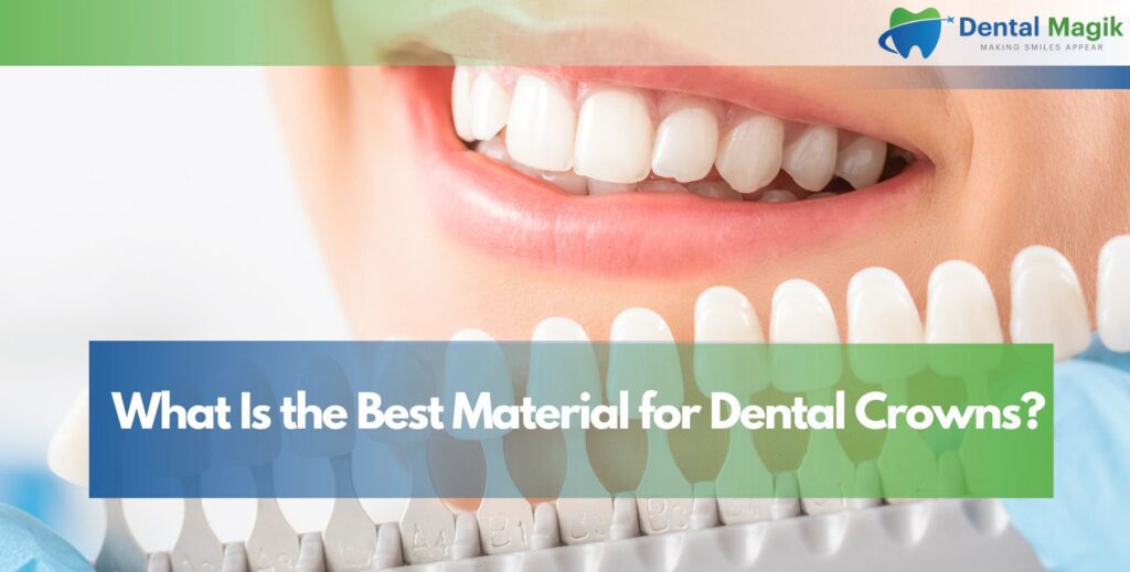 What Is the Best Material for Dental Crowns?
