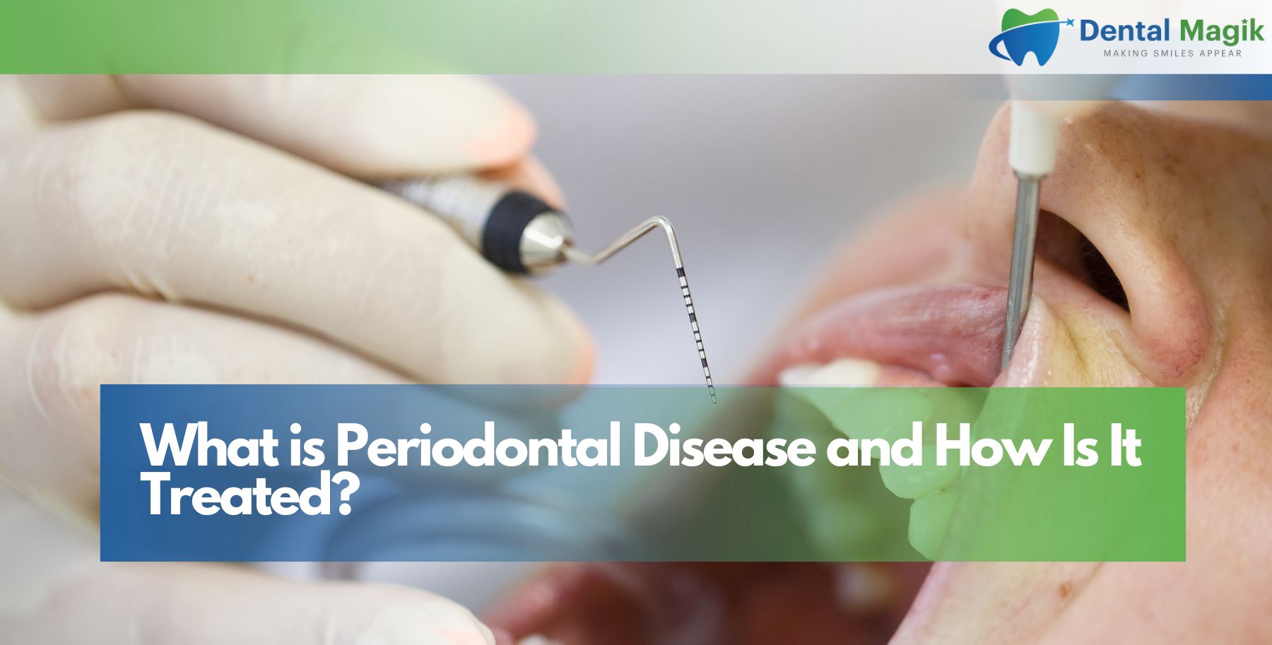 What is Periodontal Disease and How Is It Treated?