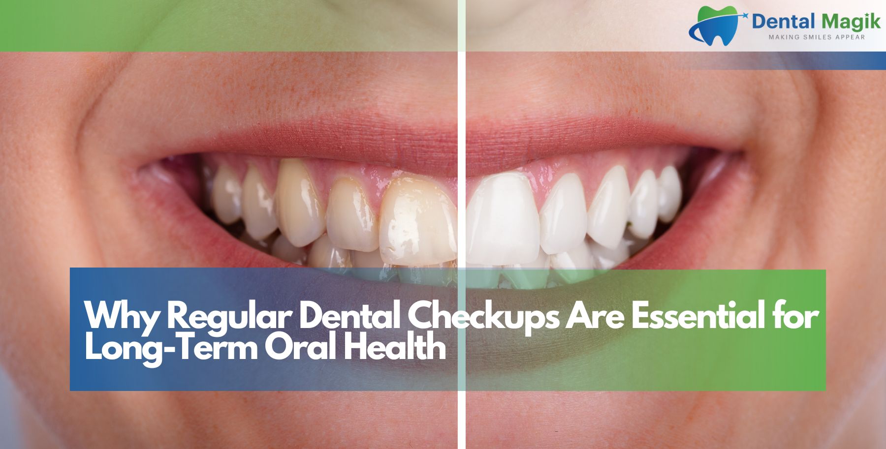 Why Regular Dental Checkups Are Essential for Long-Term Oral Health