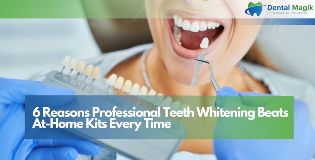 6 Reasons Professional Teeth Whitening Beats At-Home Kits Every Time