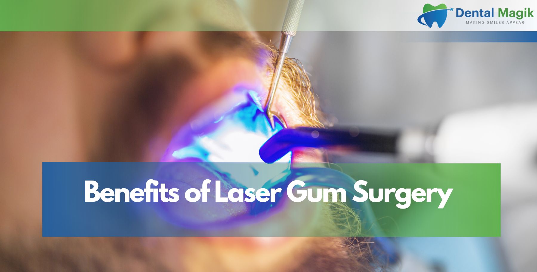 Benefits of Laser Gum Surgery