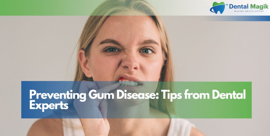 Preventing Gum Disease: Tips from Dental Experts