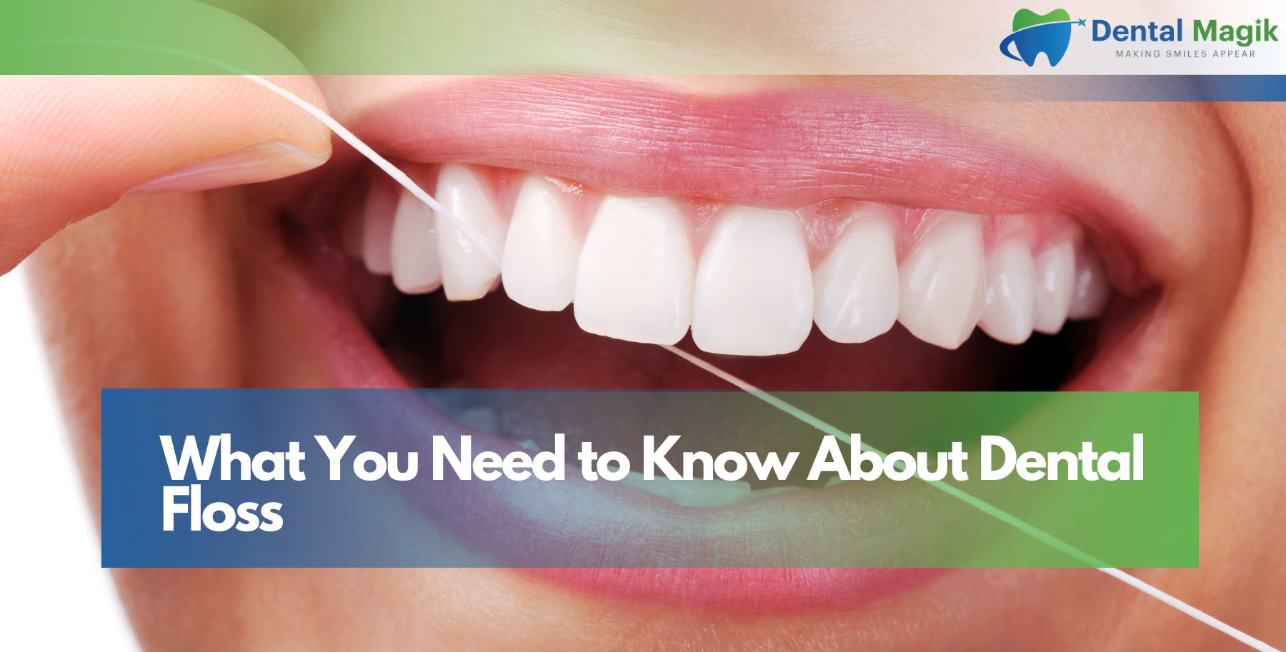 What You Need to Know About Dental Floss