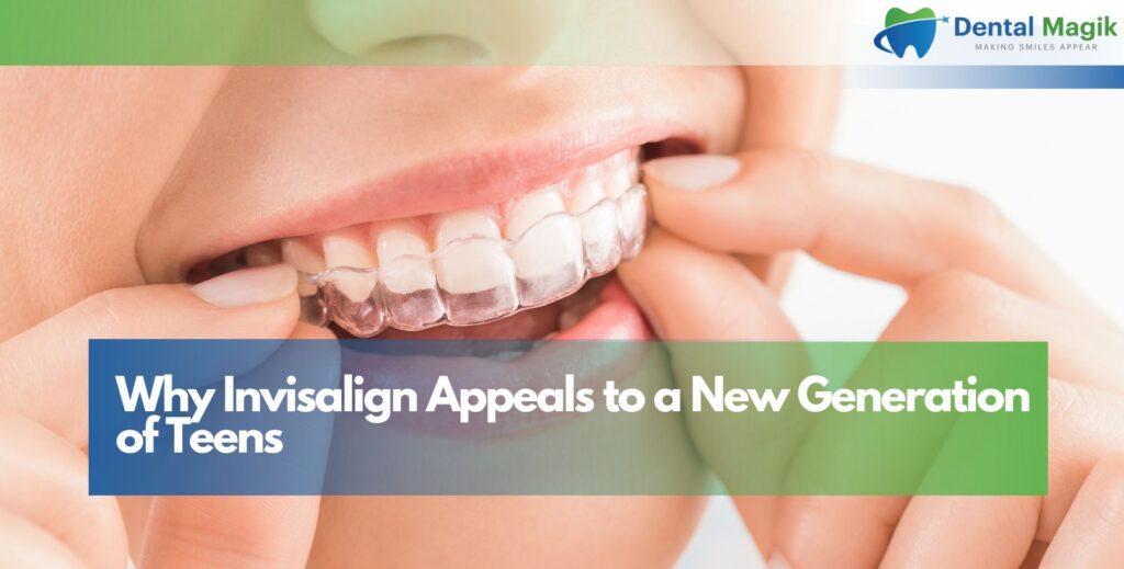 Why Invisalign Appeals to a New Generation of Teens