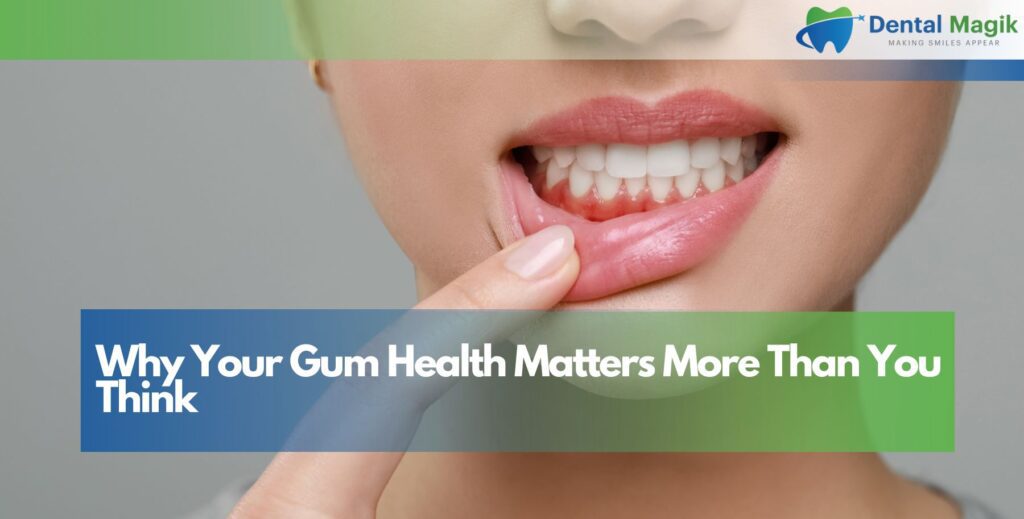 Why Your Gum Health Matters More Than You Think