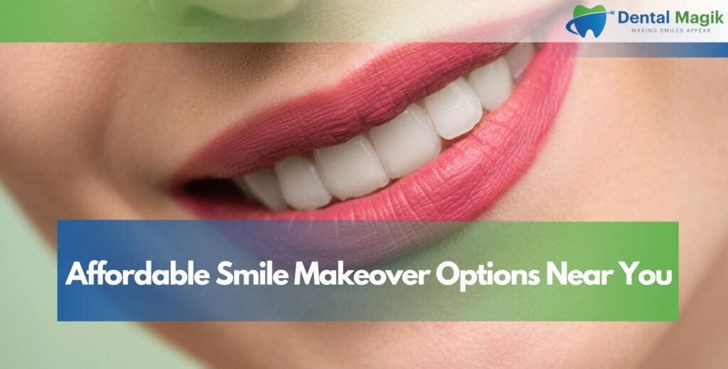 Affordable Smile Makeover Options Near You